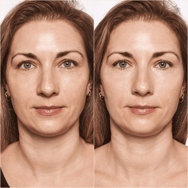 Liquide de camouflage correcteur haute couvrance Catrice